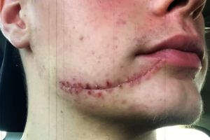 „Scarface” de la Jocurile Olimpice: are o cicatrice mare pe față și doi dinți de aur » „Era ca o sabie de samurai”