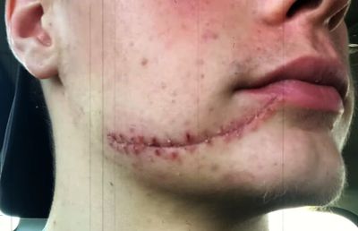 „Scarface” de la Jocurile Olimpice: are o cicatrice mare pe față și doi dinți de aur » „Era ca o sabie de samurai”