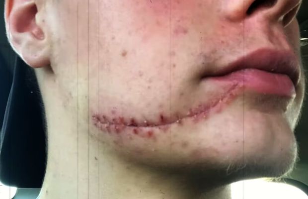 „Scarface” de la Jocurile Olimpice: are o cicatrice mare pe față și doi dinți de aur » „Era ca o sabie de samurai”