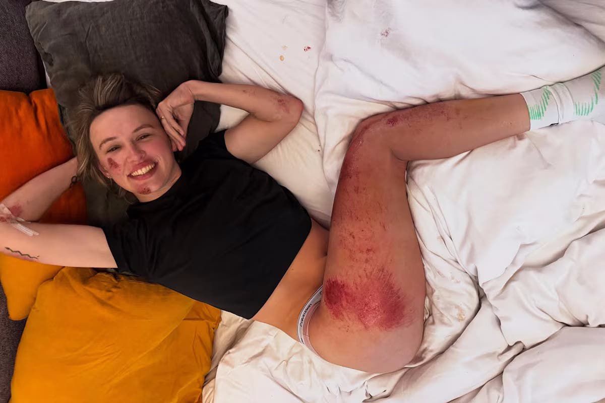 Katarzyna Niewiadoma - accidentare