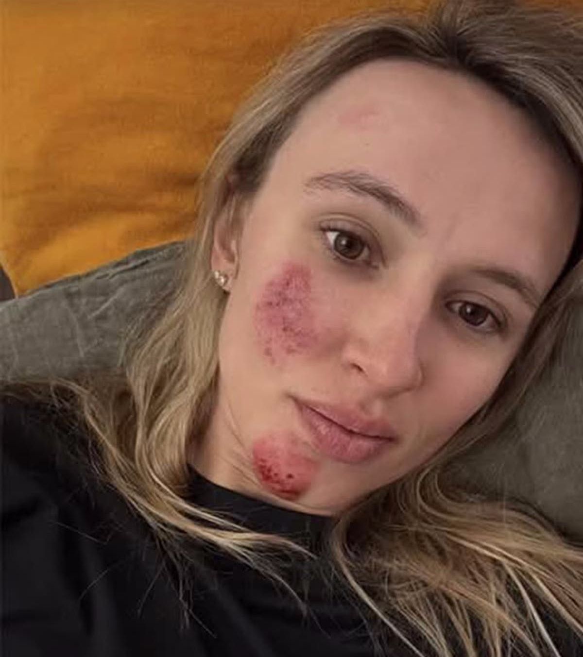 Katarzyna Niewiadoma - accidentare