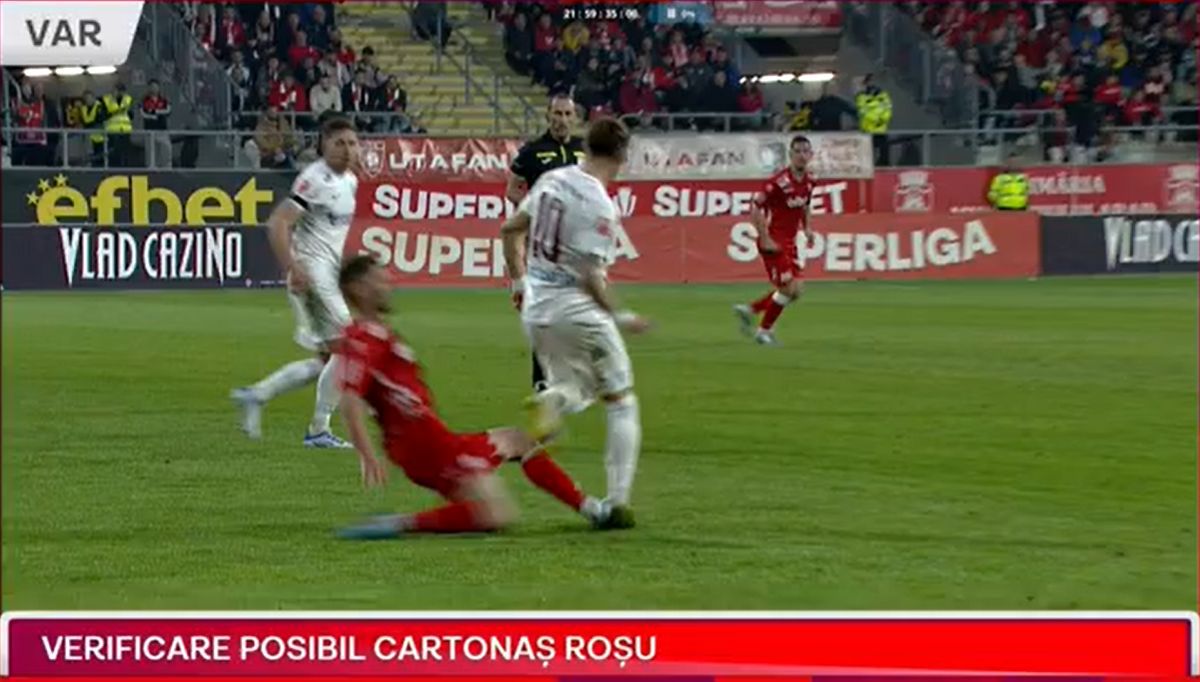 E cât un butuc! » Cum arată glezna lui Ciprian Deac, a doua zi după atacul brutal din UTA - CFR Cluj