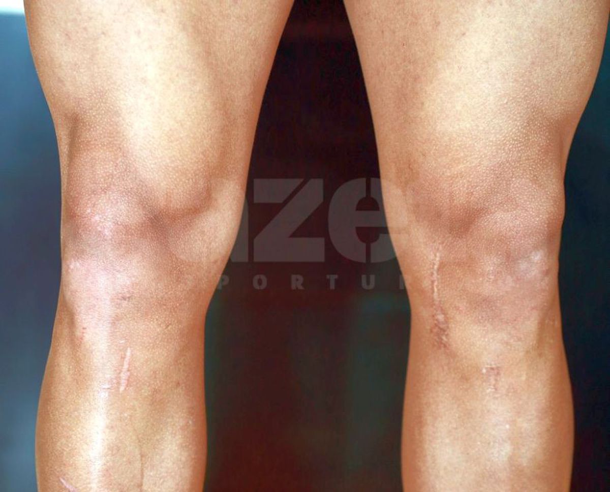 Reinventat! Urmărit de ghinioane și cu genunchii frânți, s-a transformat și rupe plasele: „Ăsta e secretul”