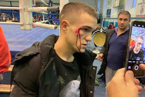 Fața lui Gabriel Șchiopu după ce a fost lovit // foto: https://www.facebook.com/gabriel.schiopu18