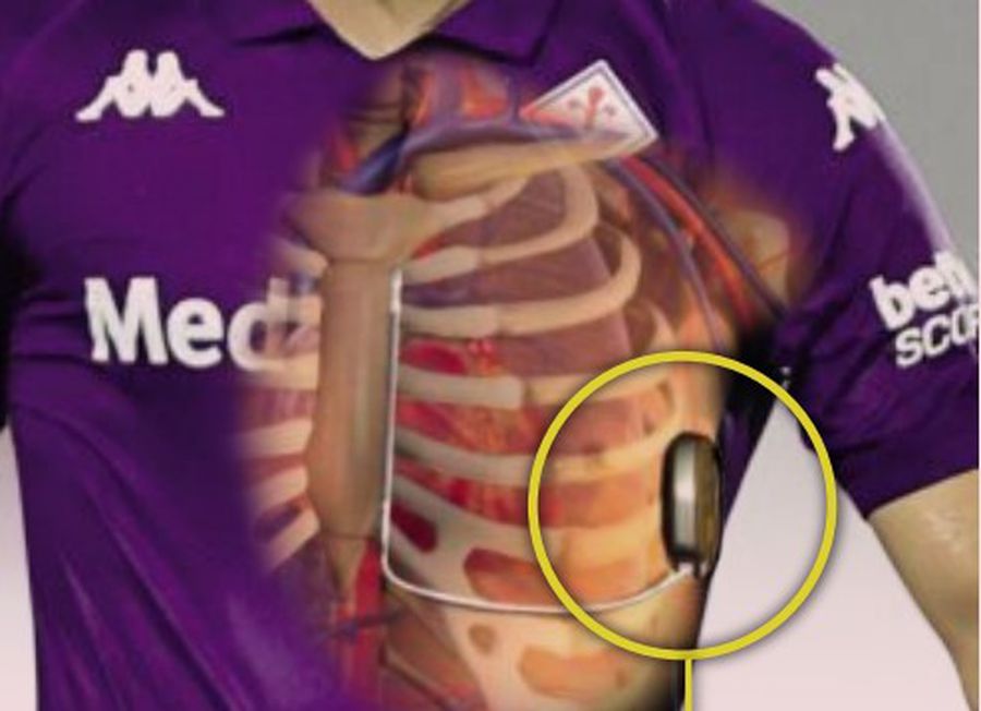 Anunțul medicilor pentru Edoardo Bove! » Mai poate reveni în teren mijlocașul italian de 23 de ani?