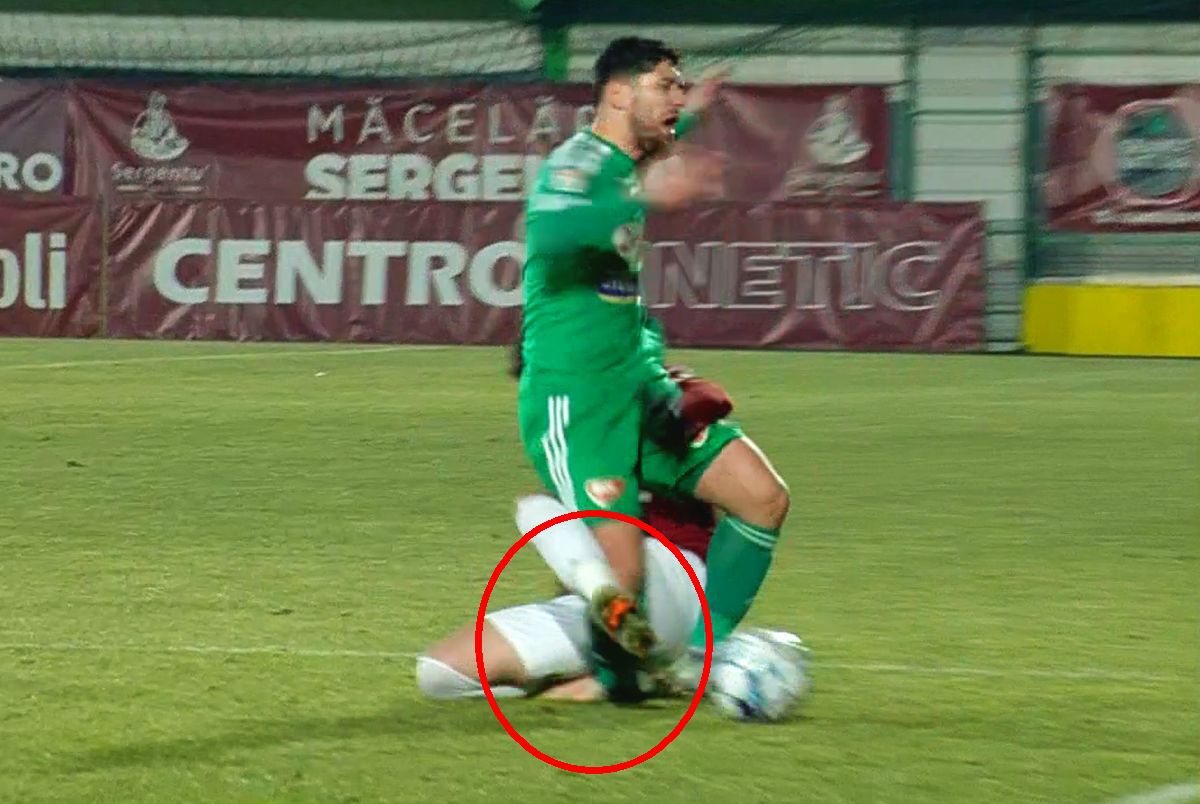 Anass Achahbar, fotbalistul accidentat de Albu, va lipsi până la 7 luni!