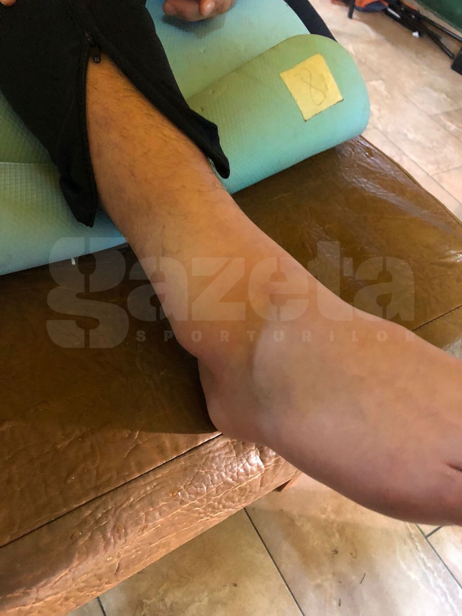 Cum arată piciorul lui Achahbar, după accidentarea din Rapid - Sepsi