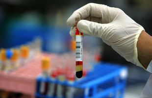 CORONAVIRUS. Hendrik Streeck, un virusolog german, demontează teoriile despre COVID-19 » Cât de ridicat e pericolul când mergi la cumpărături