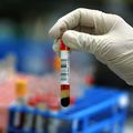 Hendrik Streeck a efectuat un studiu pentru a observa mai bine efectele pe care le are coronavirusul. foto: Guliver/Getty Images