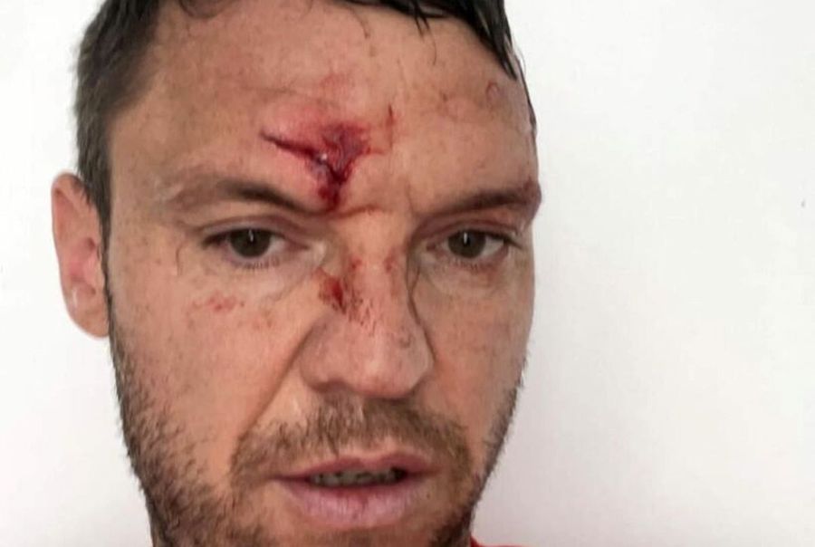 Accidentarea suferită de Cristi Bud Abia transferat la ACS FC Dinamo, Cristi Bud a suferit o accidentare oribilă: „M-am speriat”