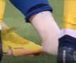Cât de grave sunt accidentările lui Miculescu și Șut: „Are o entorsă de genunchi, se pare că la ligamentul colateral extern”