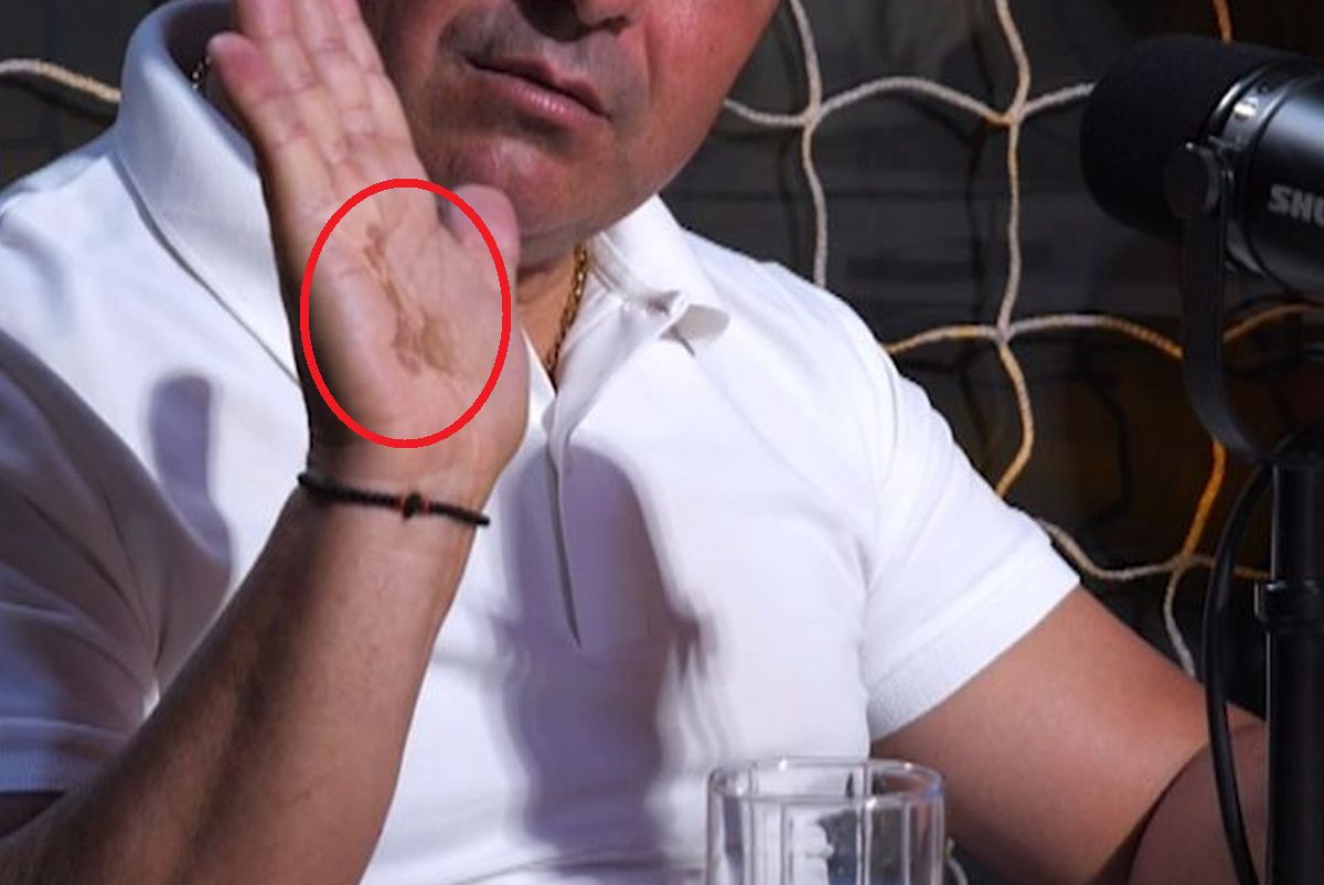 La un pas de tragedie » Imagini dure la podcastul GSP „2 la 1”: „Era să mor. Uitați-vă la mâna mea”