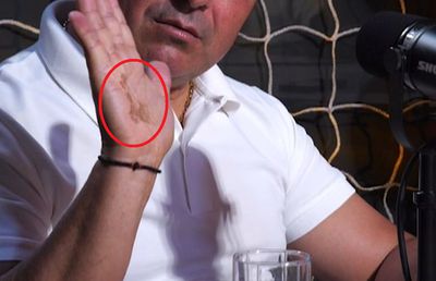 La un pas de tragedie » Imagini dure la podcastul GSP „2 la 1”: „Era să mor. Uitați-vă la mâna mea”