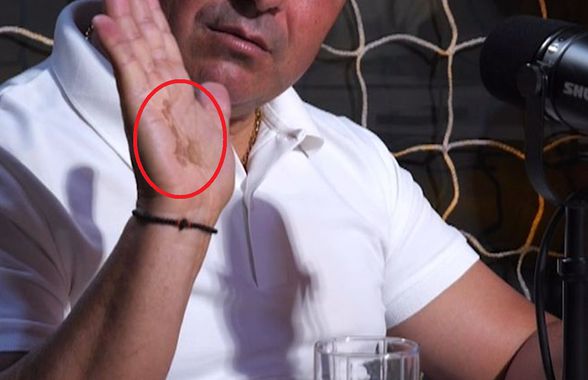 La un pas de tragedie » Imagini dure la podcastul GSP „2 la 1”: „Era să mor. Uitați-vă la mâna mea”