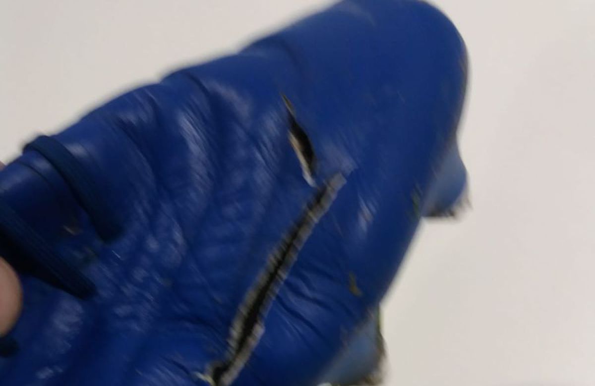 FOTO EXCLUSIV. I-a tăiat gheata în Craiova - Sepsi! Cum arată acum piciorul fotbalistului » Crăciunescu: „I-aș fi dat «roșu»!”