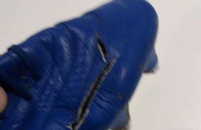 FOTO EXCLUSIV. I-a tăiat gheata în Craiova - Sepsi! Cum arată acum piciorul fotbalistului » Crăciunescu: „I-aș fi dat «roșu»!”