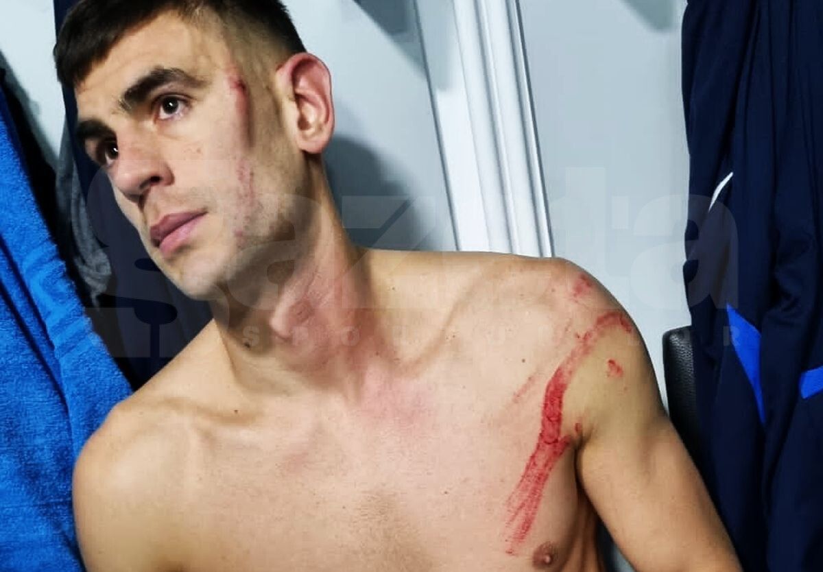 Edjouma, iertat de eliminare la Voluntari! Intrarea horror a francezului a lăsat urme: „Fault grosolan! Trebuia ROȘU direct! Ce face VAR-ul?”