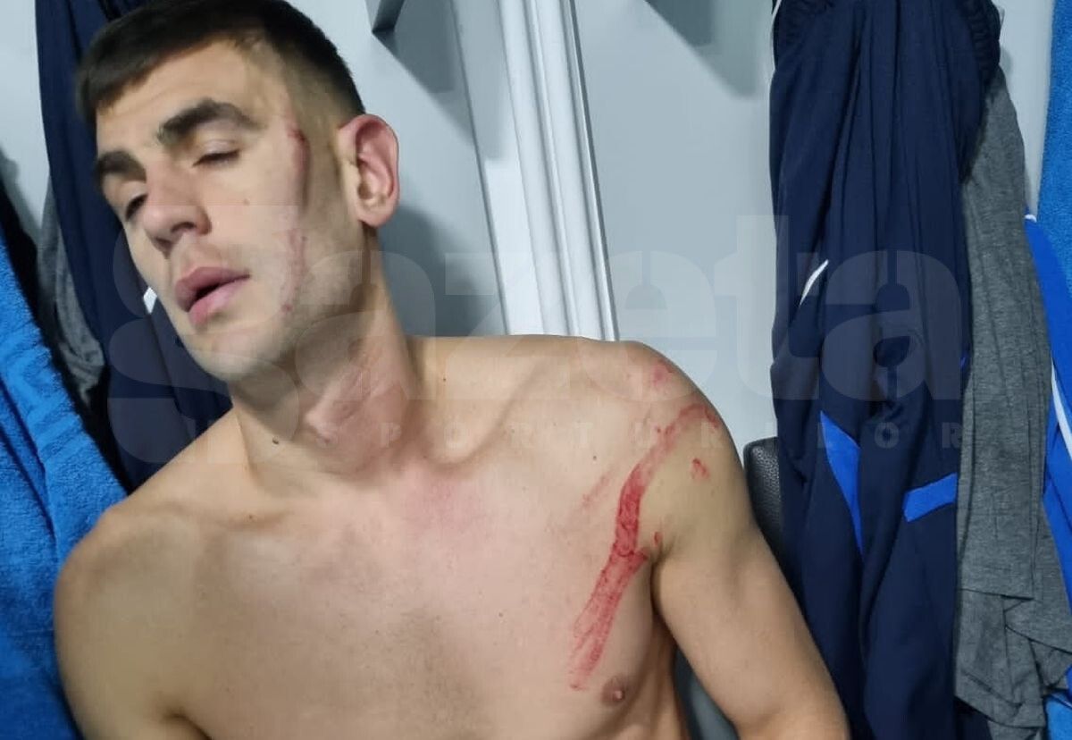 Edjouma, iertat de eliminare la Voluntari! Intrarea horror a francezului a lăsat urme: „Fault grosolan! Trebuia ROȘU direct! Ce face VAR-ul?”