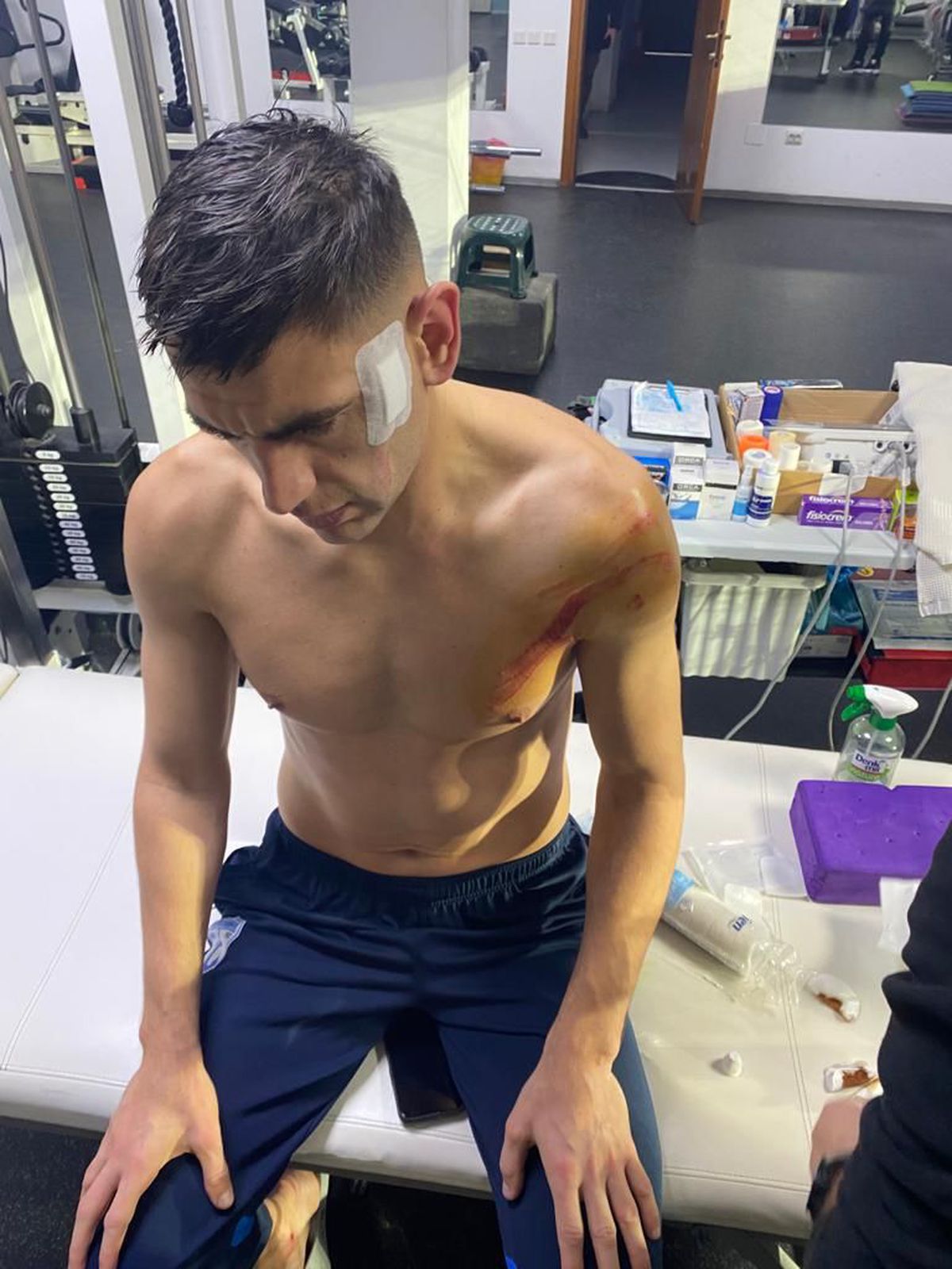 Cum se simte Armaș după faultul brutal al lui Edjouma: „Nu pot să mișc mâna” + „N-am primit niciun mesaj de la FCSB”