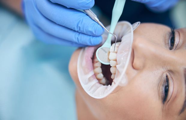 Importanța igienei orale post-implant dentar