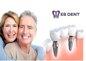 Afla ce este si ce presupune un impant dentar!