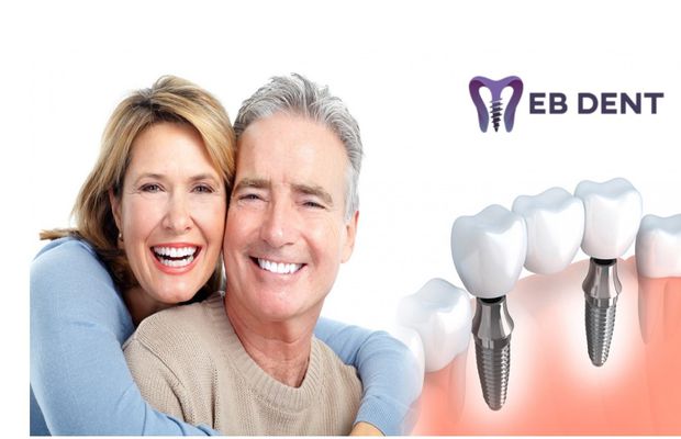 Afla ce este si ce presupune un impant dentar!