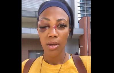 O fostă voleibalistă, bătută în plină stradă: „M-a lovit cu ceva de metal, părea o țeavă”