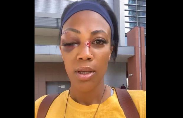 O fostă voleibalistă, bătută în plină stradă: „M-a lovit cu ceva de metal, părea o țeavă”