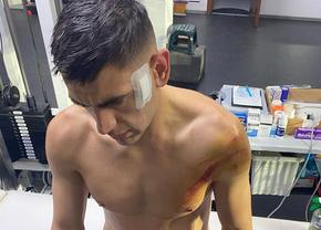Val de reacții după decizia lui Radu Petrescu din FC Voluntari - FCSB: „Armaș arată ca în Mad Max. Vassaras, nu e posibil?”