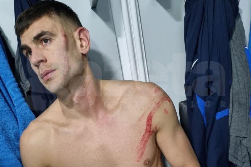 Igor Armaș (35 de ani), stoperul ilfovenilor faultat aseară brutal de Malcom Edjouma (26, mijlocaș central)