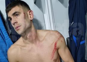 Cum se simte Armaș după faultul brutal al lui Edjouma: „Nu pot să mișc mâna” + „N-am primit niciun mesaj de la FCSB”