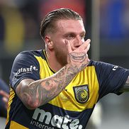 Jason Cummings și gura pe care a vrut-o tatuată pe mâna dreaptă / foto: Guliver gettyimages