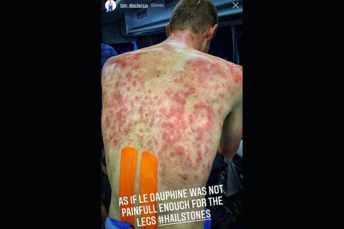 HORROR » O furtună cu gheață a lovit cursa ciclistă Criterium du Dauphine, iar unii cicliști au suferit răni severe