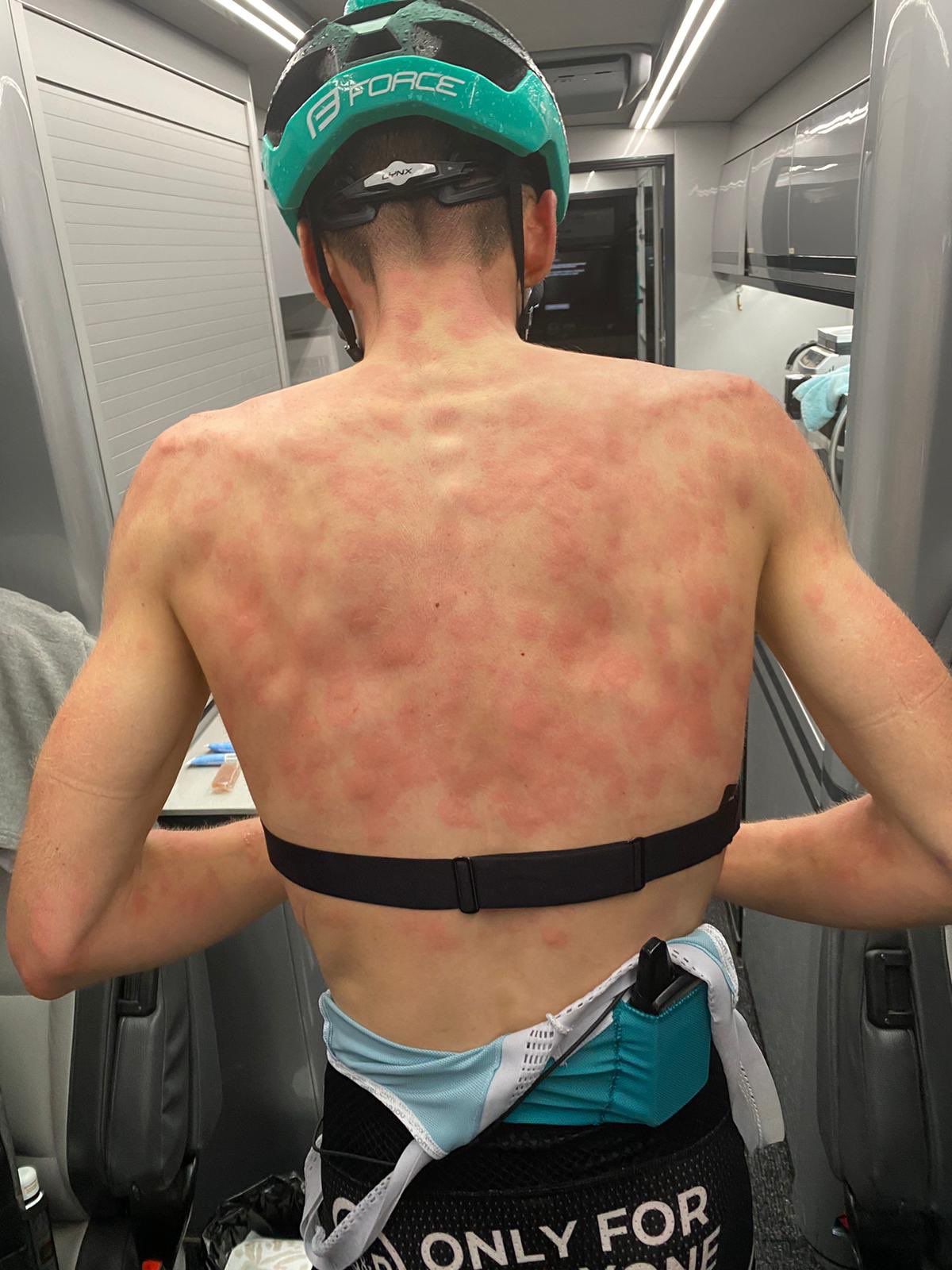 HORROR » O furtună cu gheață a lovit cursa ciclistă Criterium du Dauphine, iar unii cicliști au suferit răni severe