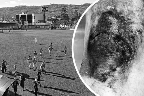 Florian Haită s-a ales cu o accidentare groaznică pe „tăpșanul” de la Câmpulung / Fotomontaj Diana Vasilescu