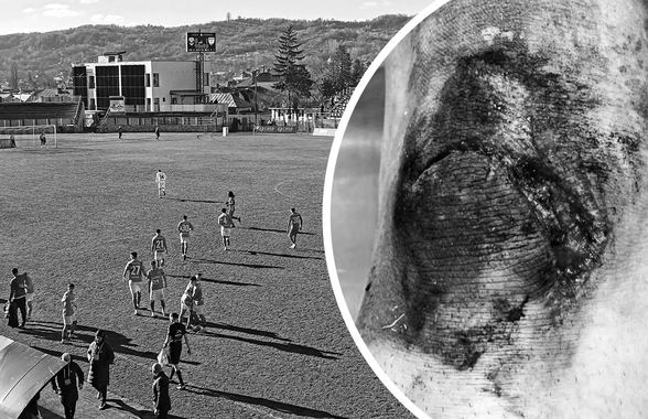 Accidentare de coșmar în Liga 2 din România! Fotbalistul crescut de Hagi și-a făcut franjuri genunchiul: „Am căzut într-o buză de canal din fier!” » Reacția clubului: „Ce canal? Era nisip”