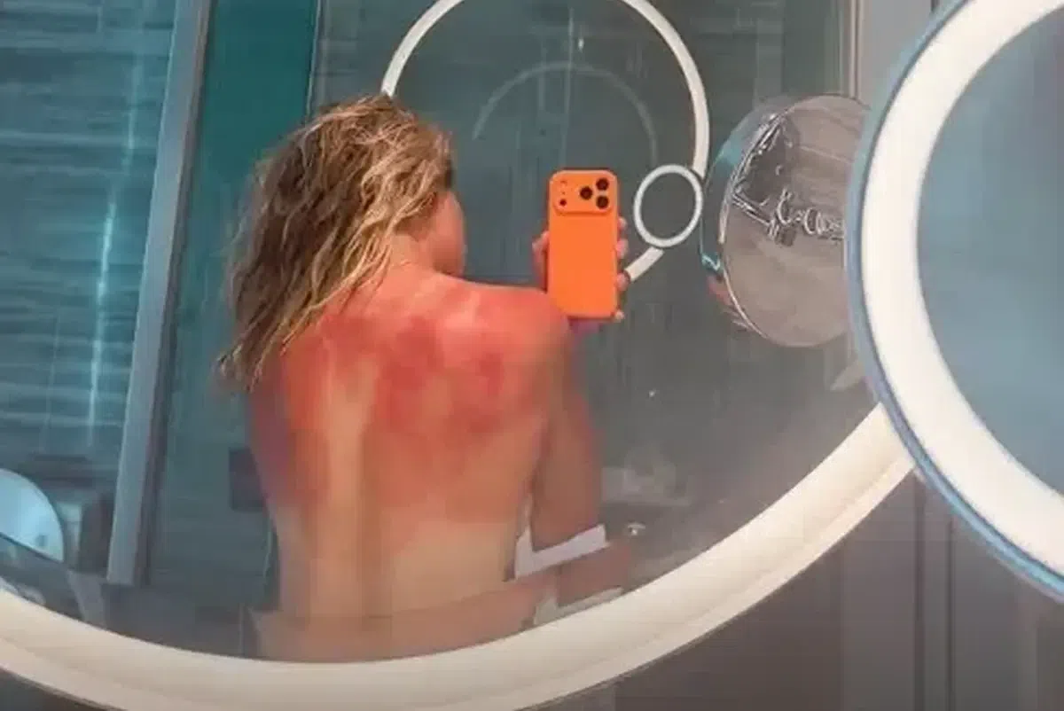 Arsuri severe înainte de Australian Open: „Nu e de glumă cu soarele de aici”