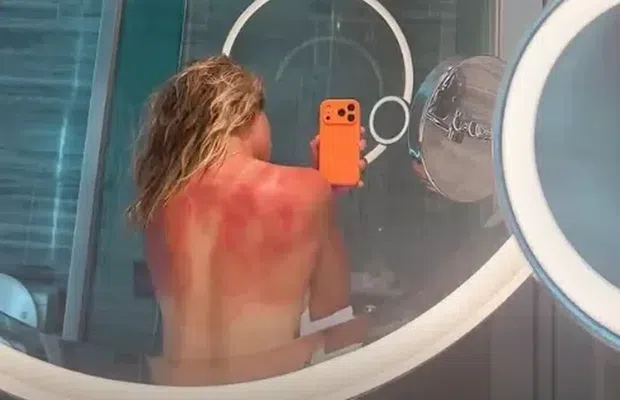 Arsuri severe înainte de Australian Open: „Nu e de glumă cu soarele de aici”