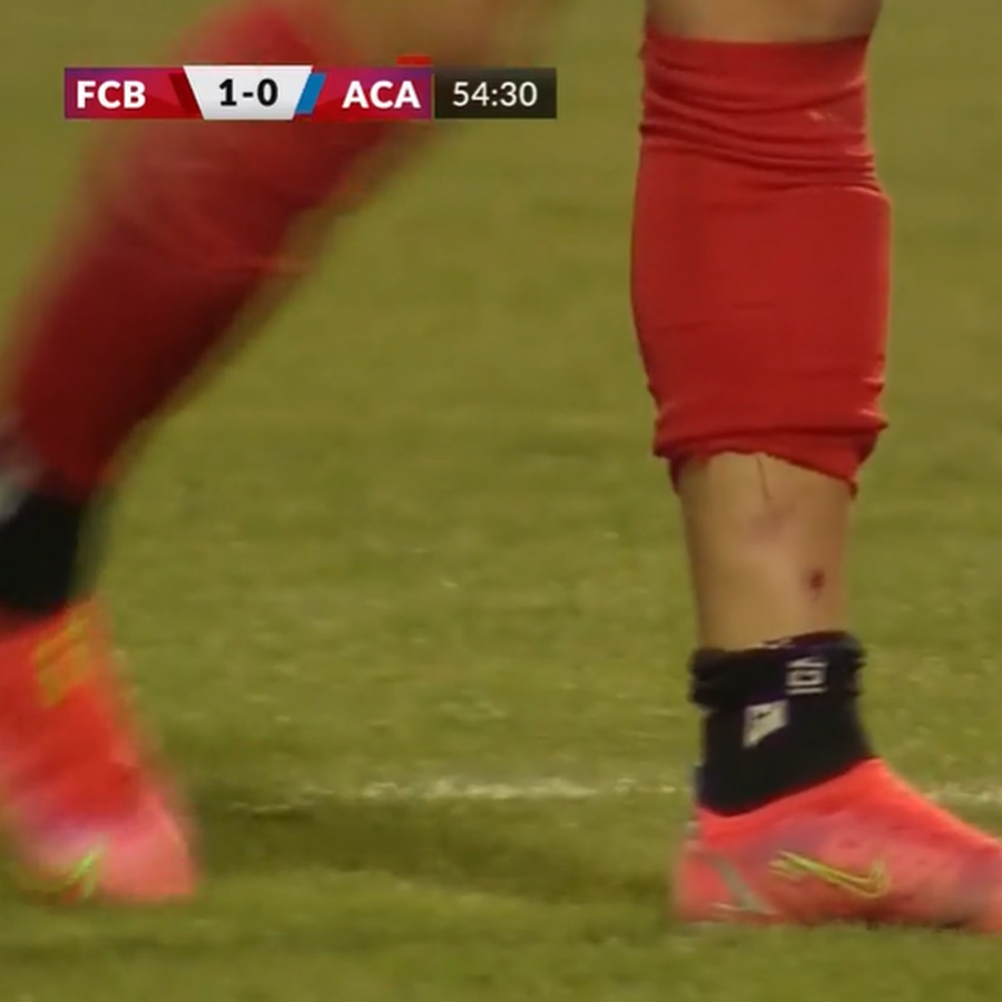 Urmele faultului Putea să-i rupă piciorul! Intrare violentă în Liga 1 » Arbitrul și-a schimbat decizia