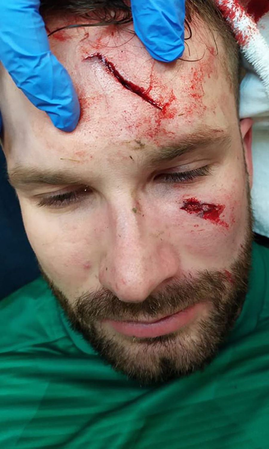 Așa arată accidentarea lui Ondrej Kolar, foto: twitter Așa arată accidentarea lui Ondrej Kolar, foto: twitter