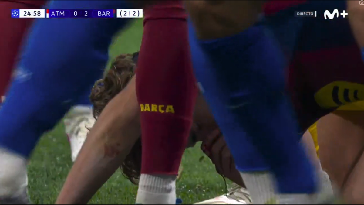 Accidentare Fermin Lopez // foto: capturi X și Imago