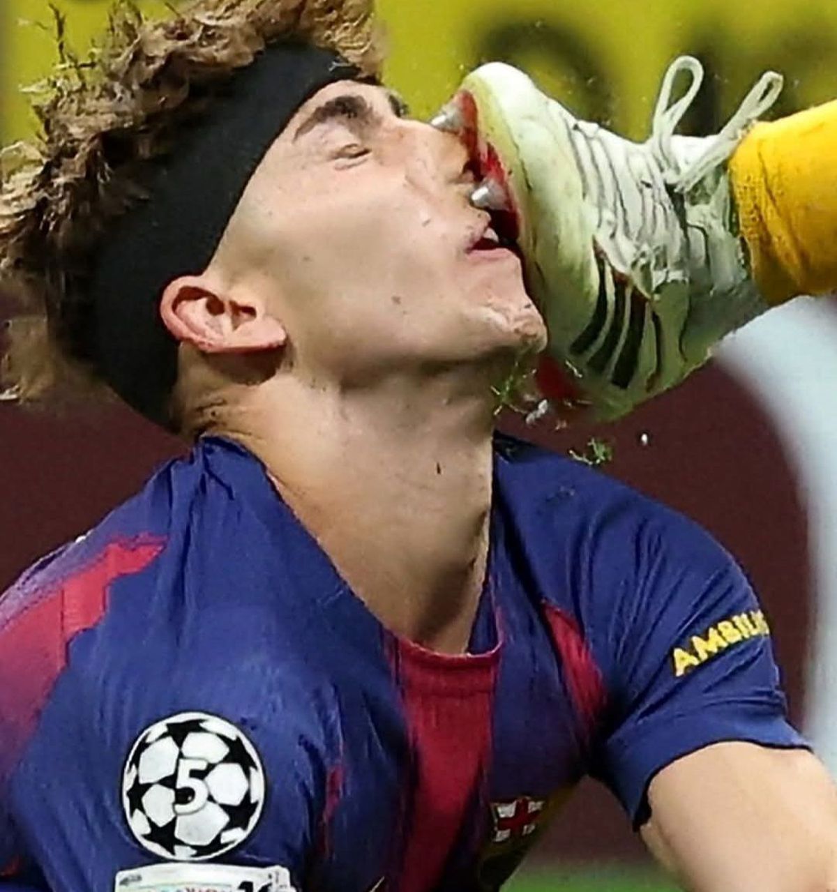 Accidentare Fermin Lopez // foto: capturi X și Imago