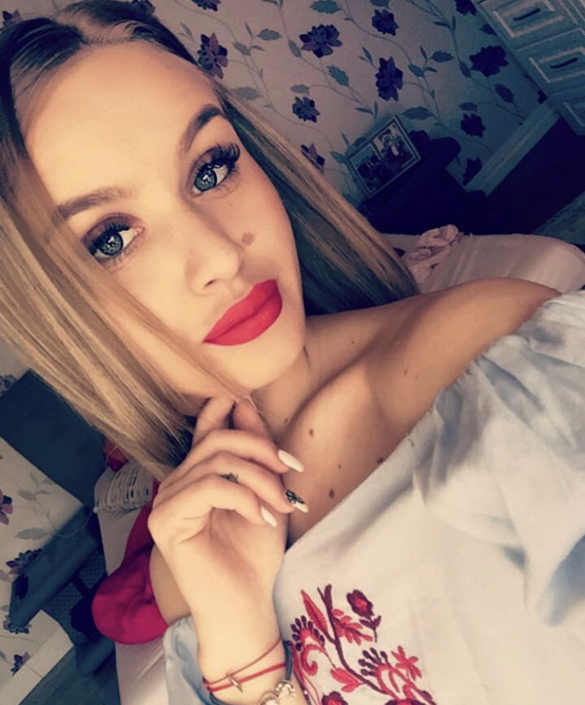 Stranierul și-a povestit calvarul, la aproape un an de la teribila accidentare: „E a doua operație, acum, la celălalt picior. Niciodată n-am mai fost așa”