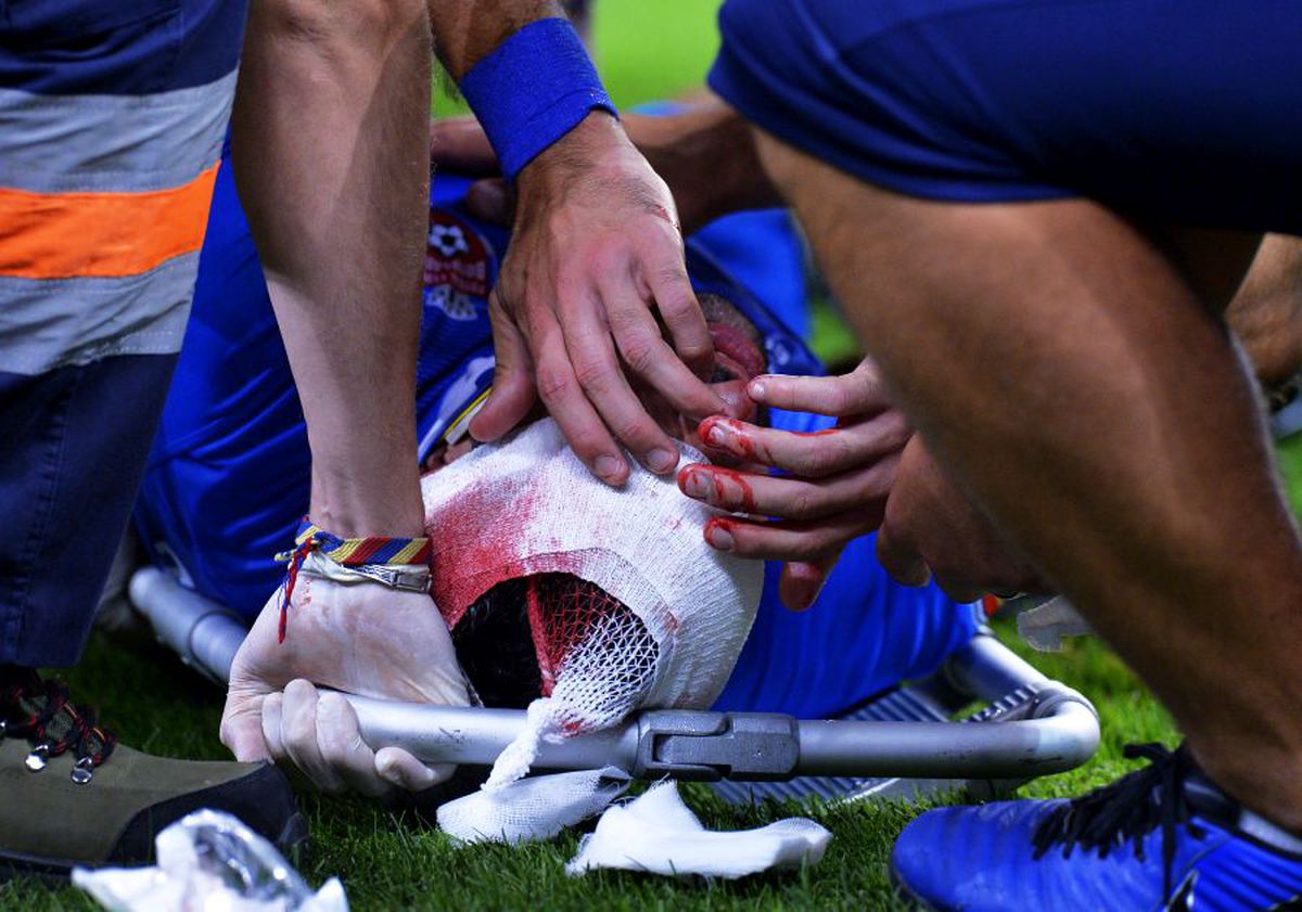 DINAMO - FC BOTOȘANI 1-1 // UPDATE+FOTO Ce diagnostic i-au pus medicii lui Moussa după ciocnirea cu Pap » Atenție, imagini dure cu accidentarea!