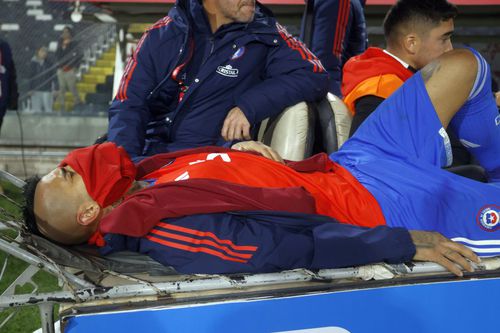 Arturo Vidal s-a accidentat în Chile - Columbia 0-0. 
Foto: Imago