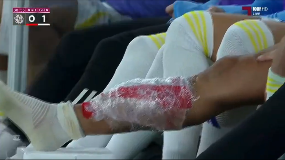 Florinel Coman s-a accidentat în duelul cu echipa lui Cosmin Contra » Exces de zel al arbitrului