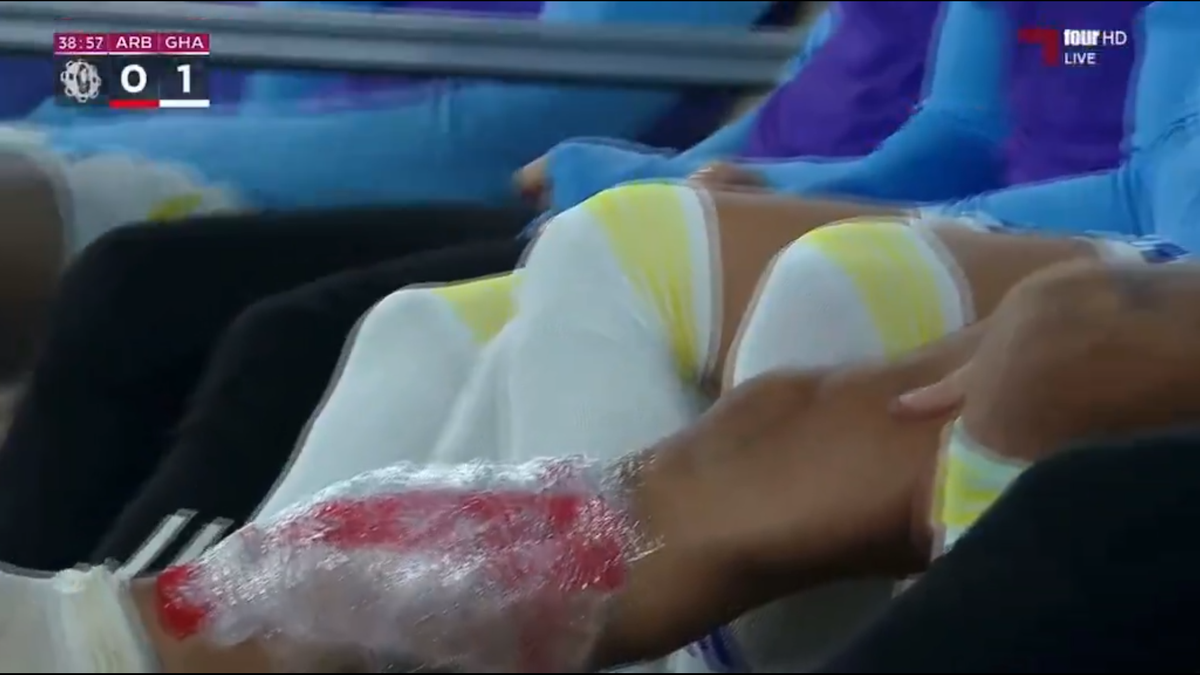 Florinel Coman s-a accidentat în duelul cu echipa lui Cosmin Contra » Exces de zel al arbitrului