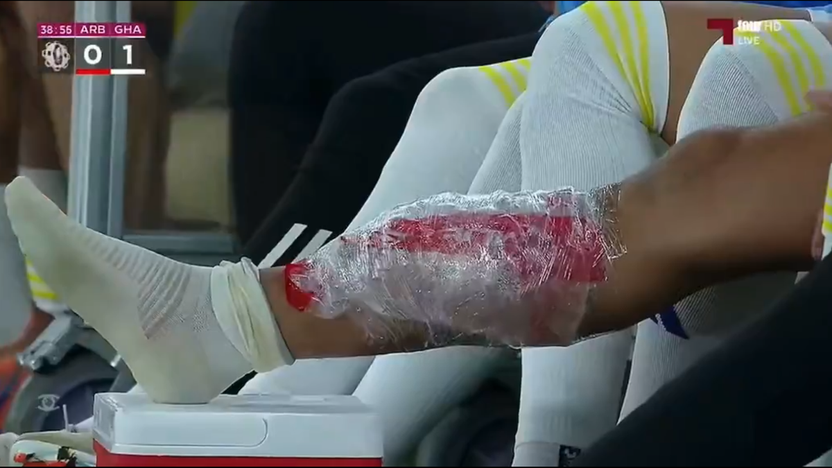 Florinel Coman s-a accidentat în duelul cu echipa lui Cosmin Contra » Exces de zel al arbitrului