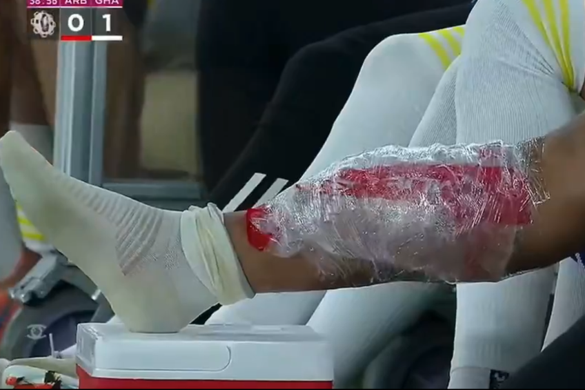 FOTO Florinel Coman s-a accidentat în duelul cu echipa lui Cosmin Contra » Exces de zel al arbitrului