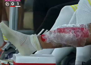 Florinel Coman s-a accidentat în duelul cu echipa lui Cosmin Contra » Exces de zel al arbitrului